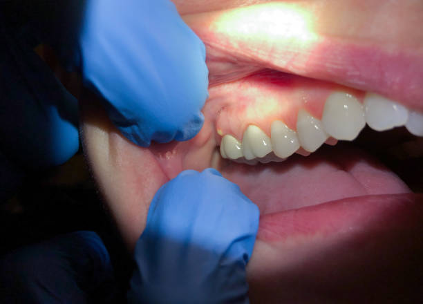 Best Emergency Dentist No Insurance  in Onancock, VA